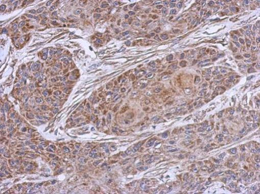 NDUFB4 Antibody in Immunohistochemistry (Paraffin) (IHC (P))