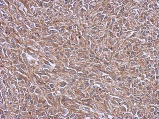 NDUFB4 Antibody in Immunohistochemistry (Paraffin) (IHC (P))