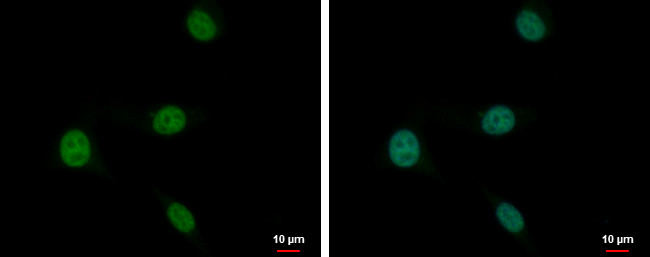 PLZF Antibody in Immunocytochemistry (ICC/IF)