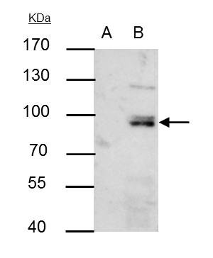 PI3K p85 alpha Antibody in Immunoprecipitation (IP)