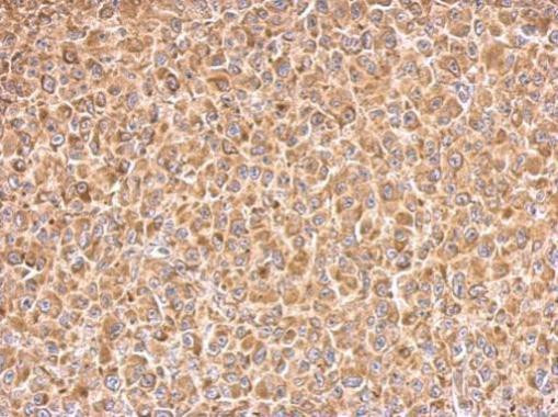 PAK1 Antibody in Immunohistochemistry (Paraffin) (IHC (P))