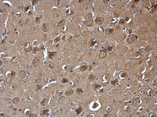 PAK1 Antibody in Immunohistochemistry (Paraffin) (IHC (P))