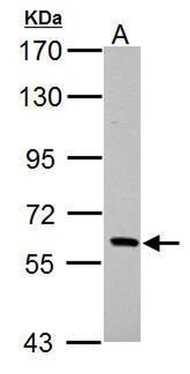 PAK1 Antibody in Western Blot (WB)