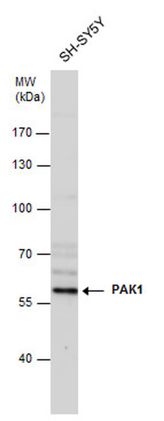 PAK1 Antibody in Western Blot (WB)