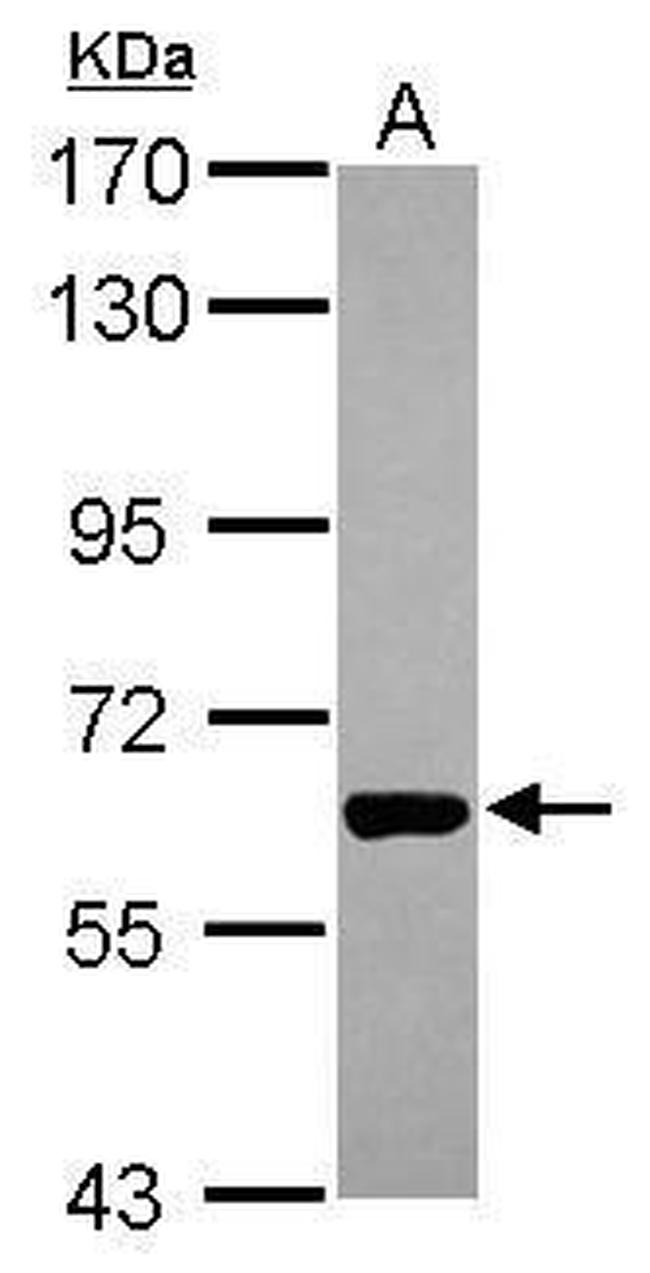 PAK1 Antibody in Western Blot (WB)