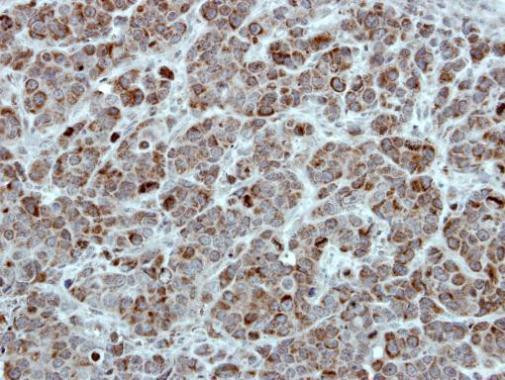 TID1 Antibody in Immunohistochemistry (Paraffin) (IHC (P))