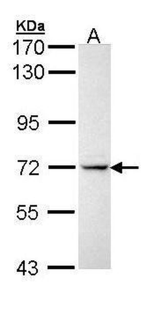 IL1R1 Antibody in Western Blot (WB)