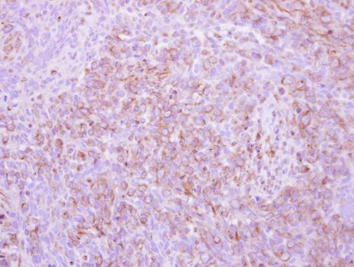 pro-EGF Antibody in Immunohistochemistry (Paraffin) (IHC (P))