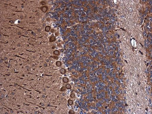 INHA Antibody in Immunohistochemistry (Paraffin) (IHC (P))