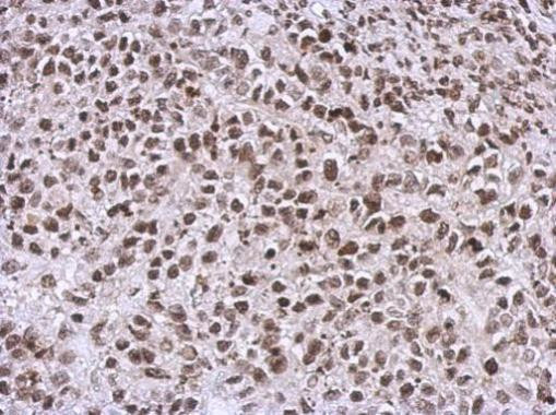 NCK1 Antibody in Immunohistochemistry (Paraffin) (IHC (P))