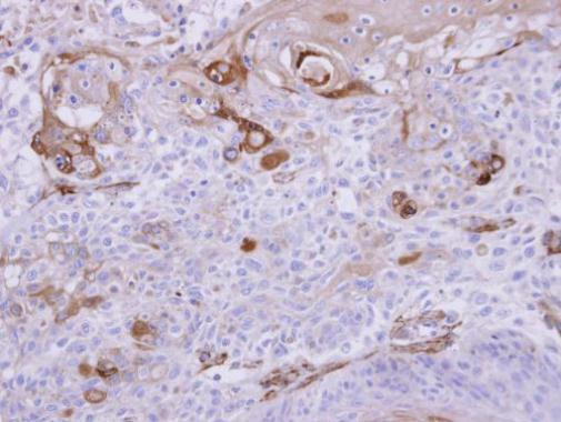 HIPPI Antibody in Immunohistochemistry (Paraffin) (IHC (P))