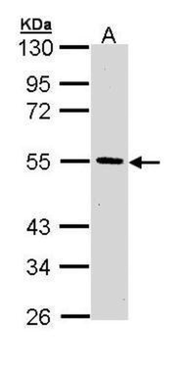 HIPPI Antibody in Western Blot (WB)