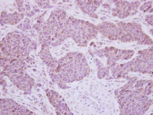 MEK5 Antibody in Immunohistochemistry (Paraffin) (IHC (P))