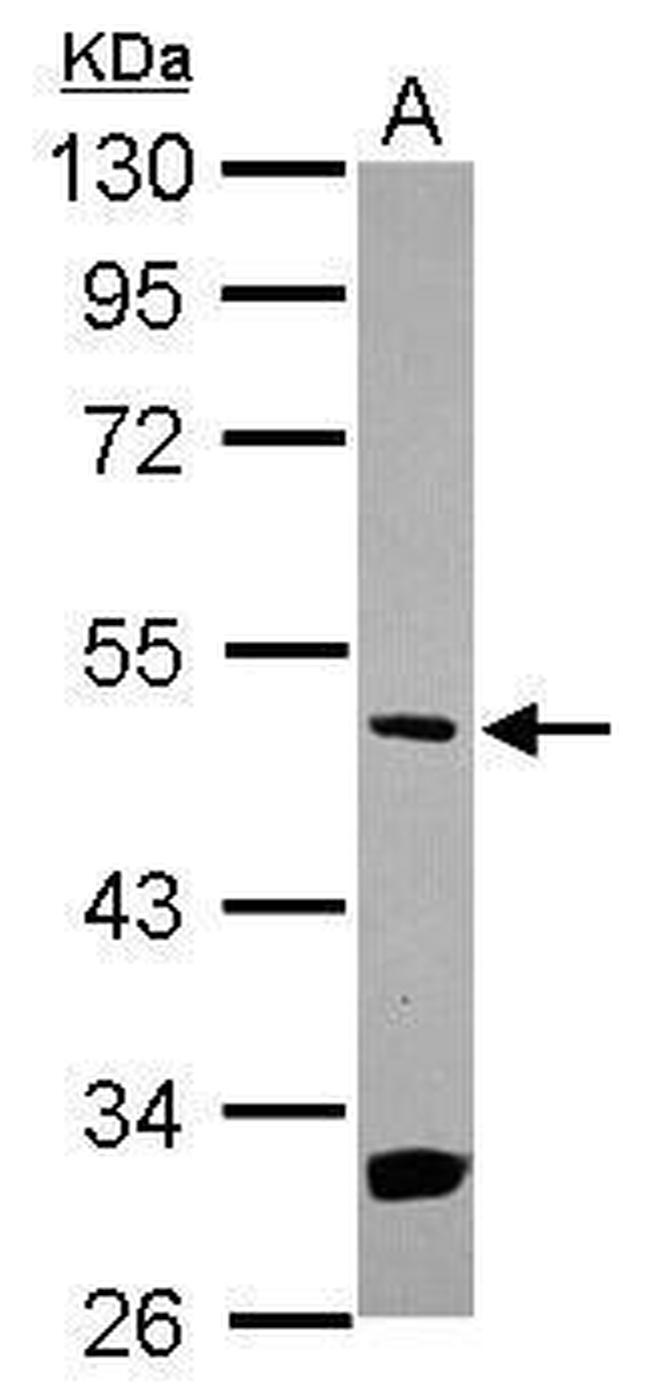 MEK5 Antibody in Western Blot (WB)