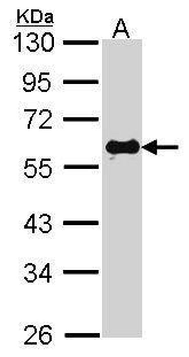 SMAD2 Antibody in Western Blot (WB)