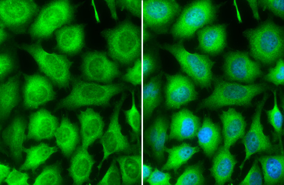 TRAF2 Antibody in Immunocytochemistry (ICC/IF)