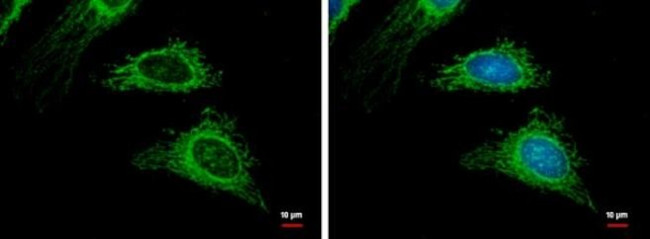 TRAF2 Antibody in Immunocytochemistry (ICC/IF)