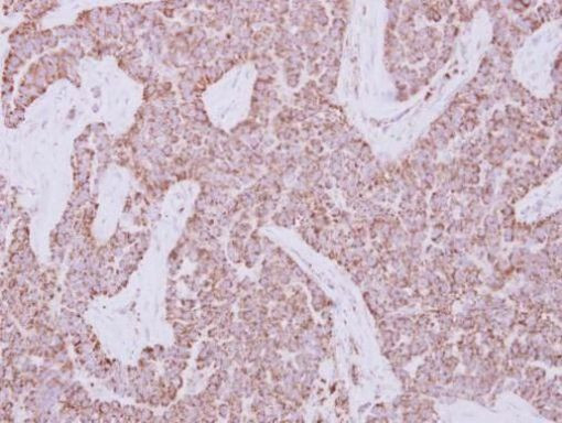 TRAF2 Antibody in Immunohistochemistry (Paraffin) (IHC (P))