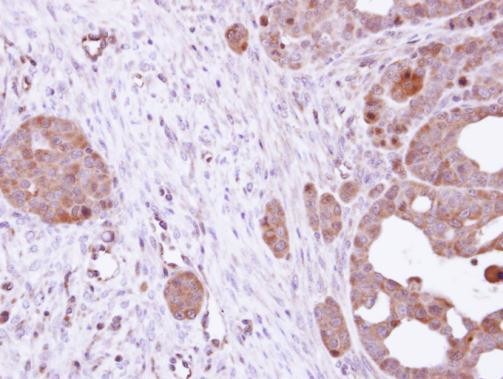 HSC70 Antibody in Immunohistochemistry (Paraffin) (IHC (P))