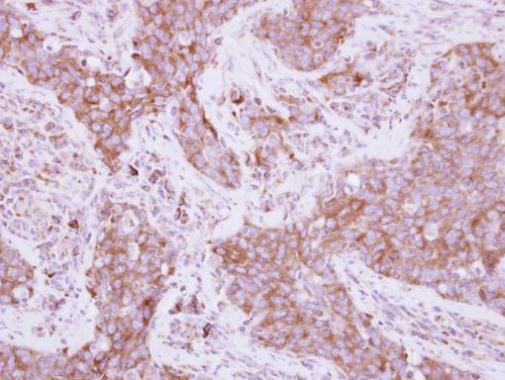 EEF1D Antibody in Immunohistochemistry (Paraffin) (IHC (P))