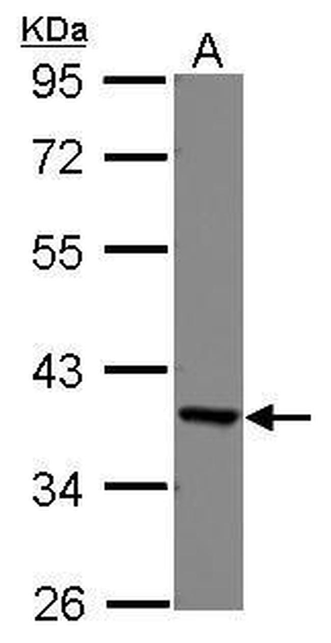 EEF1D Antibody in Western Blot (WB)