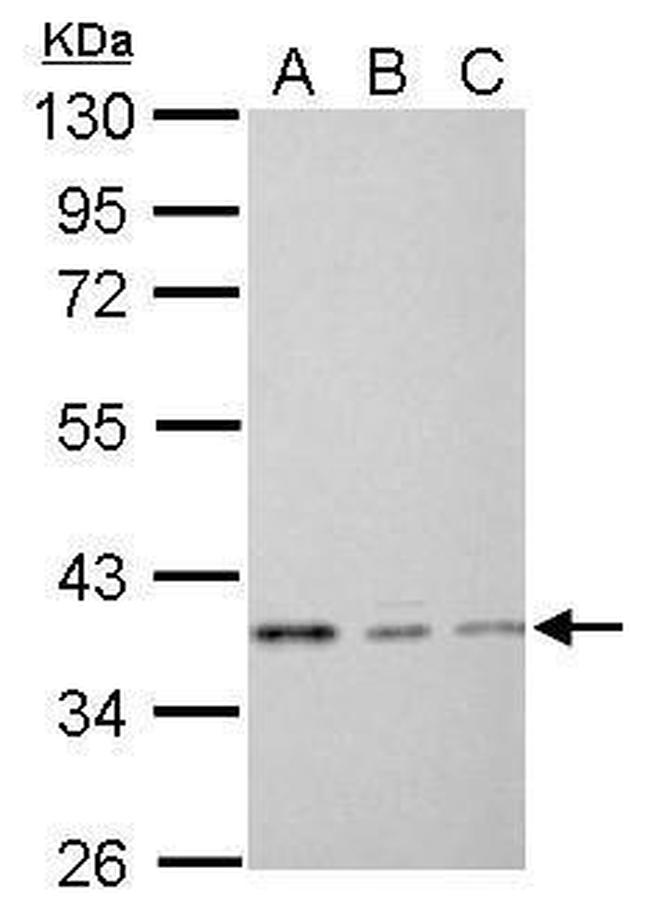 EEF1D Antibody in Western Blot (WB)