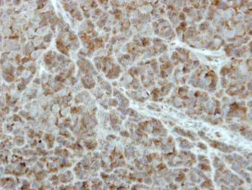 PCPTP1 Antibody in Immunohistochemistry (Paraffin) (IHC (P))