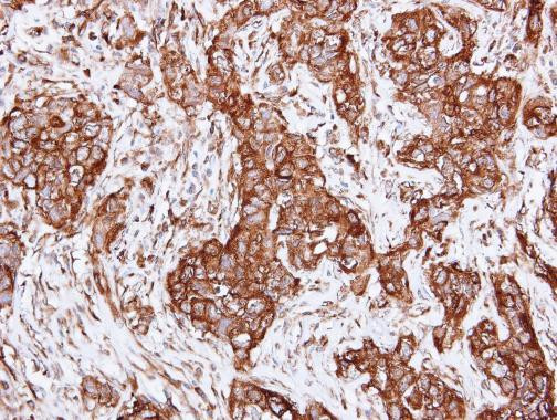 alpha Actinin 2 Antibody in Immunohistochemistry (Paraffin) (IHC (P))