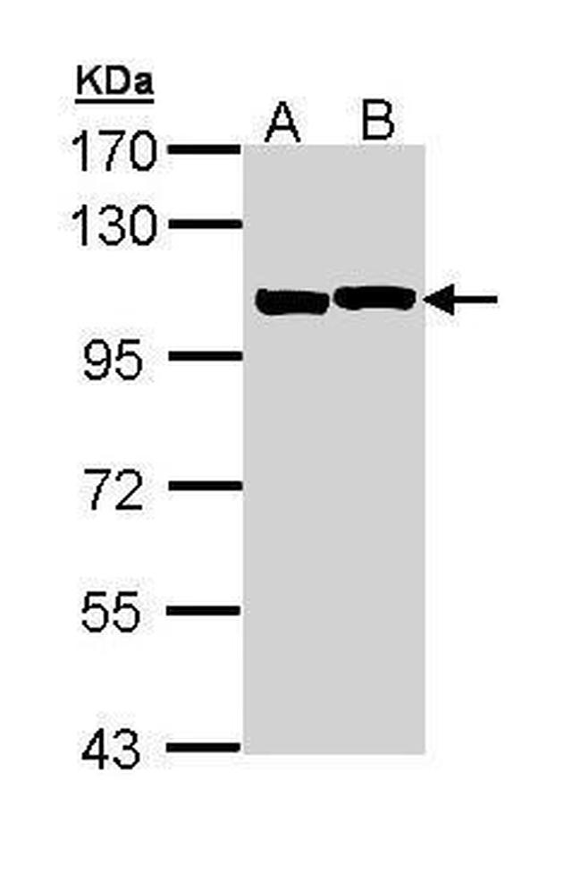 alpha Actinin 2 Antibody in Western Blot (WB)