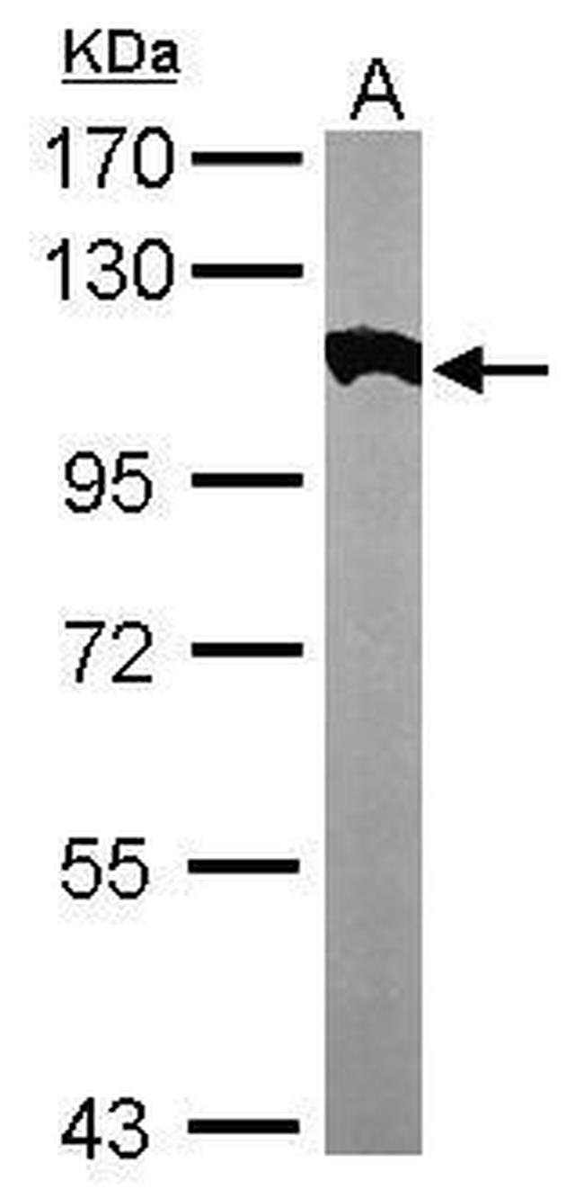 alpha Actinin 2 Antibody in Western Blot (WB)