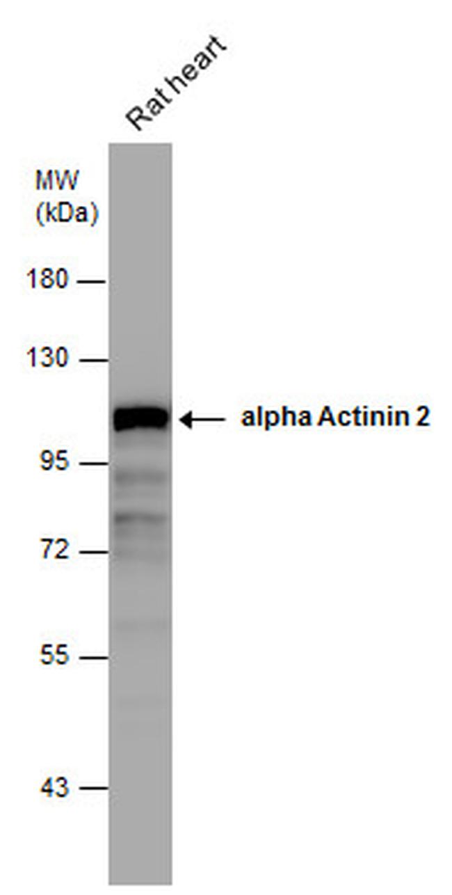 alpha Actinin 2 Antibody in Western Blot (WB)