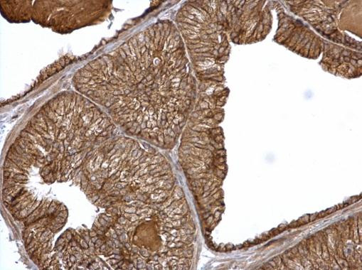 alpha Catenin Antibody in Immunohistochemistry (Paraffin) (IHC (P))