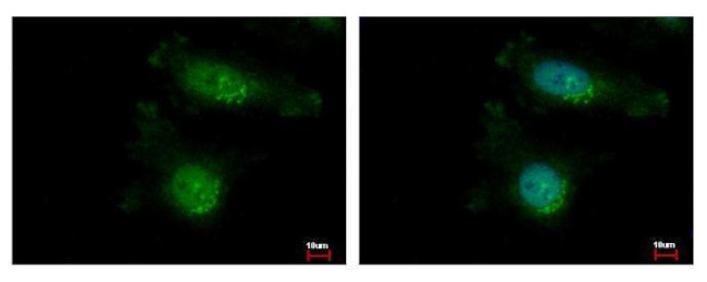 TAOK2 Antibody in Immunocytochemistry (ICC/IF)