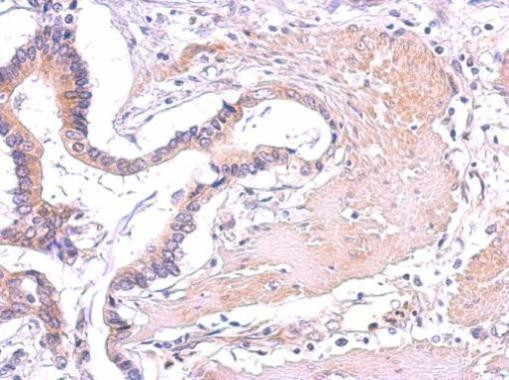 PLCG2 Antibody in Immunohistochemistry (Paraffin) (IHC (P))