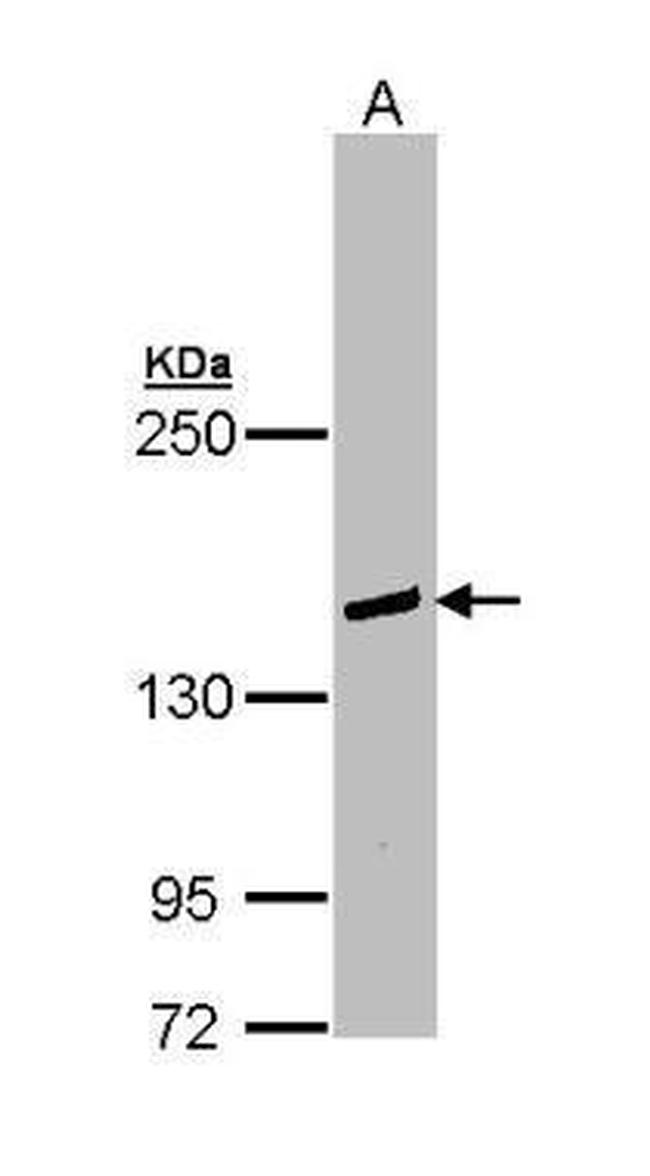 PLCG2 Antibody in Western Blot (WB)