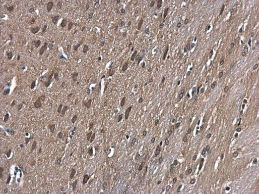 GSK3B Antibody in Immunohistochemistry (Paraffin) (IHC (P))