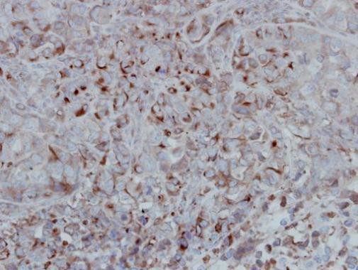 GSK3B Antibody in Immunohistochemistry (Paraffin) (IHC (P))