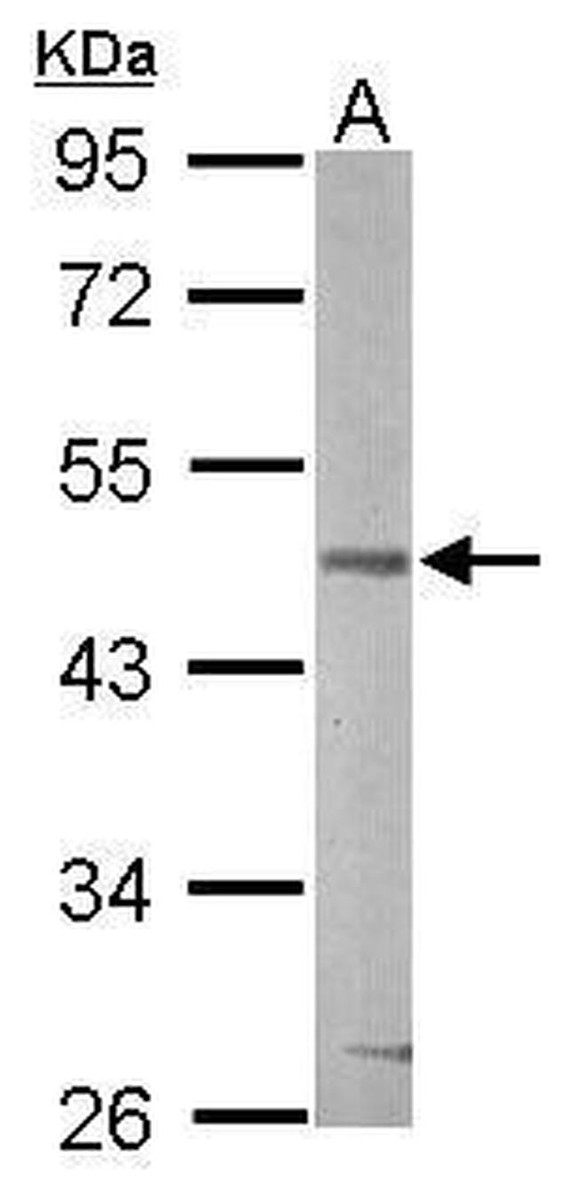 GSK3B Antibody in Western Blot (WB)