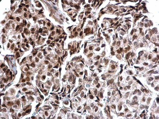 Calcineurin A Antibody in Immunohistochemistry (Paraffin) (IHC (P))