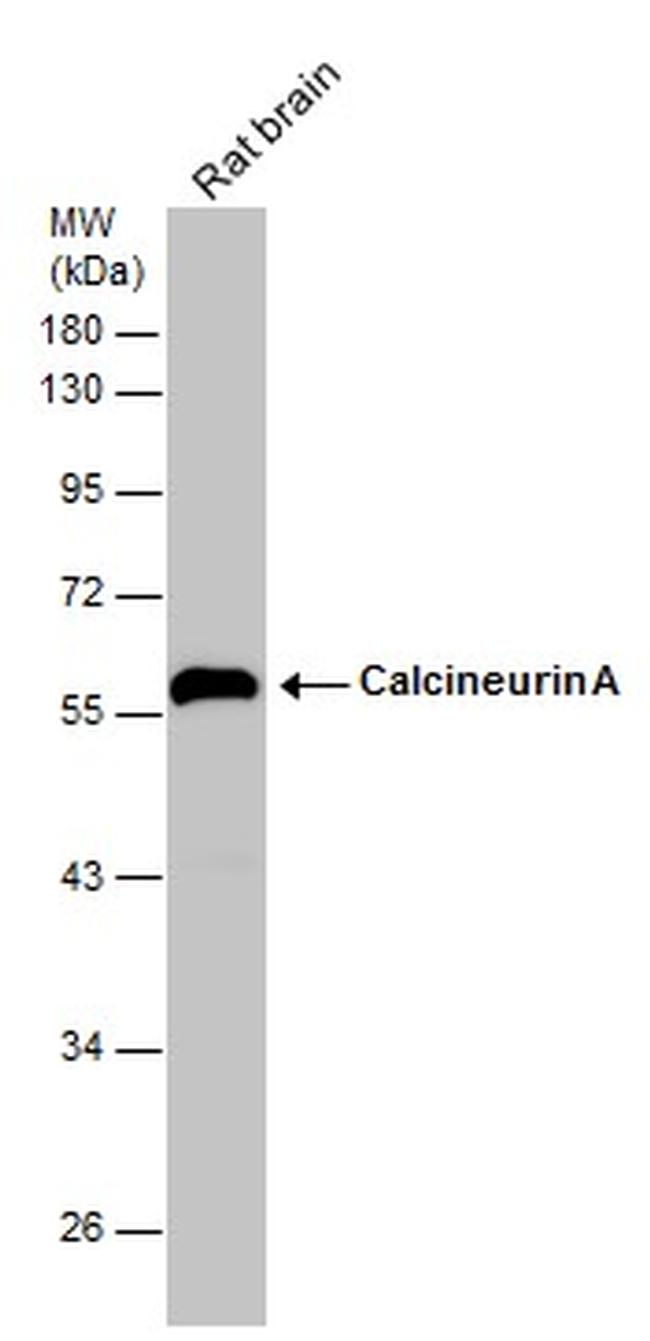 Calcineurin A Antibody in Western Blot (WB)