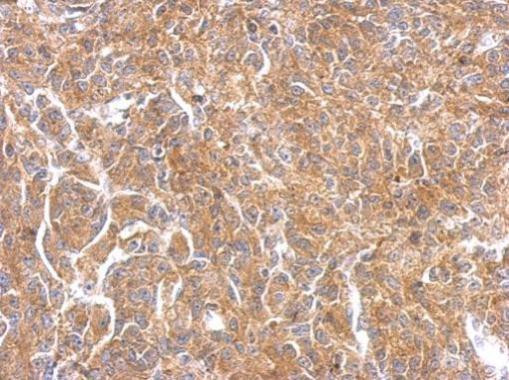 PAK1 Antibody in Immunohistochemistry (Paraffin) (IHC (P))