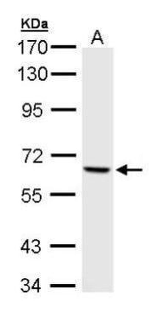 PAK1 Antibody in Western Blot (WB)