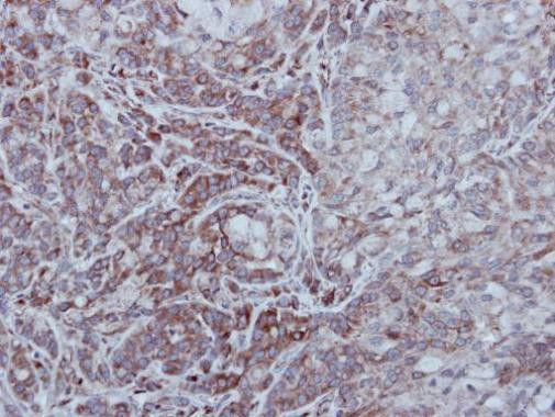 STEP Antibody in Immunohistochemistry (Paraffin) (IHC (P))