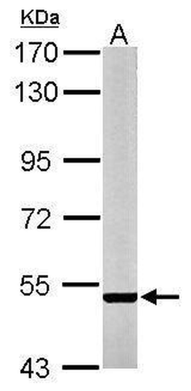 STEP Antibody in Western Blot (WB)