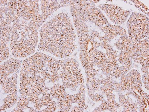 CARD10 Antibody in Immunohistochemistry (Paraffin) (IHC (P))