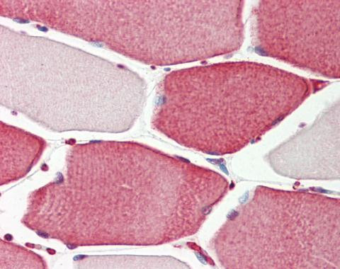 APIP Antibody in Immunohistochemistry (Paraffin) (IHC (P))