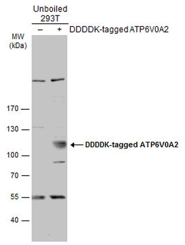 ATP6V0A2 Antibody in Western Blot (WB)