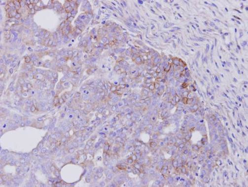 ErbB4 Antibody in Immunohistochemistry (Paraffin) (IHC (P))