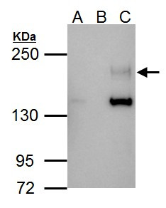 ErbB4 Antibody in Immunoprecipitation (IP)