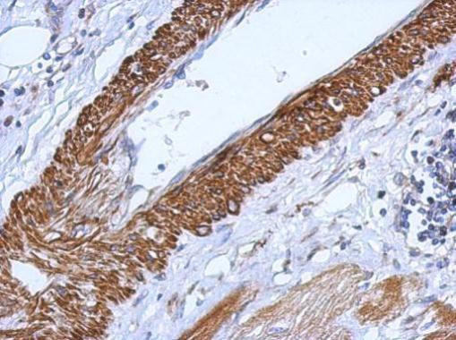 CARD6 Antibody in Immunohistochemistry (Paraffin) (IHC (P))